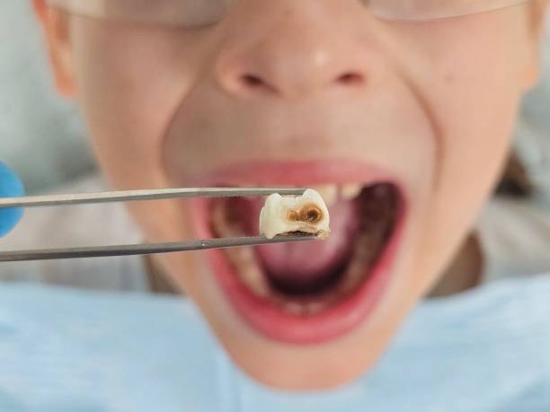Best Urgent Tooth Repair  in Alto, TX