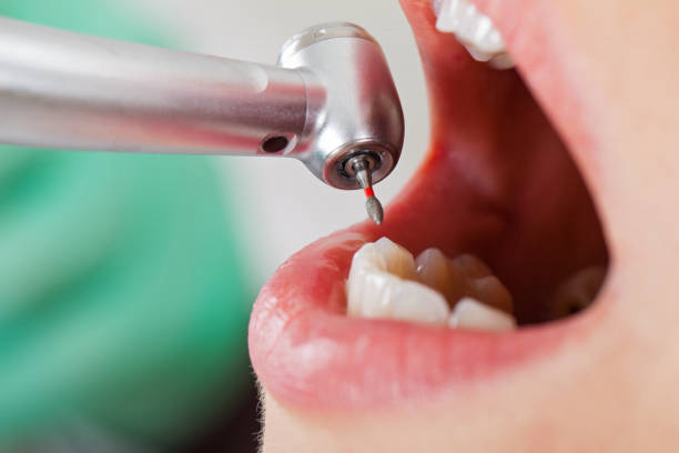 Best Tooth Infection Emergency Dentist  in Alto, TX